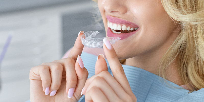 Invisalign Cape Coral FL